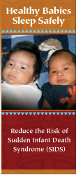 SIDS_image